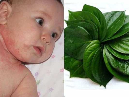 trẻ sơ sinh hăm cổ