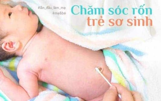 chăm sóc cuống rốn bé