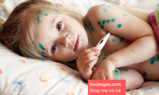 Bệnh thủy đậu là như thế nào?