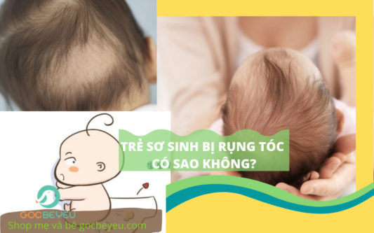 Trẻ sơ sinh rụng tóc có sao không?