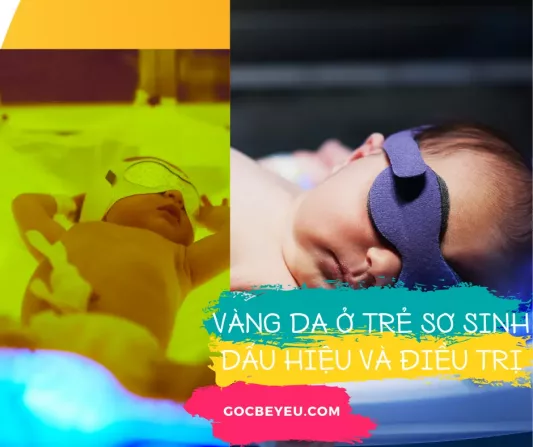 Chỉ số vàng da ở trẻ sơ sinh và các dấu hiện nhận biết