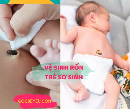 Cách vệ sinh rốn cho trẻ sơ sinh trước và sau khi rụng